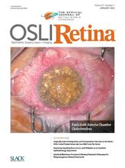 Ophthalmic Surgery Lasers And Imaging Retina